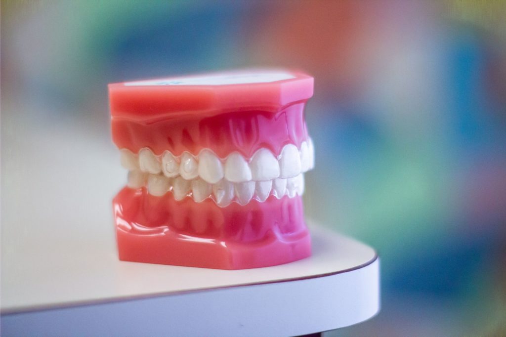 Model of teeth demonstrating proper alignment