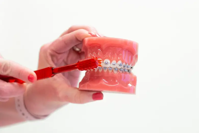 miami fl braces