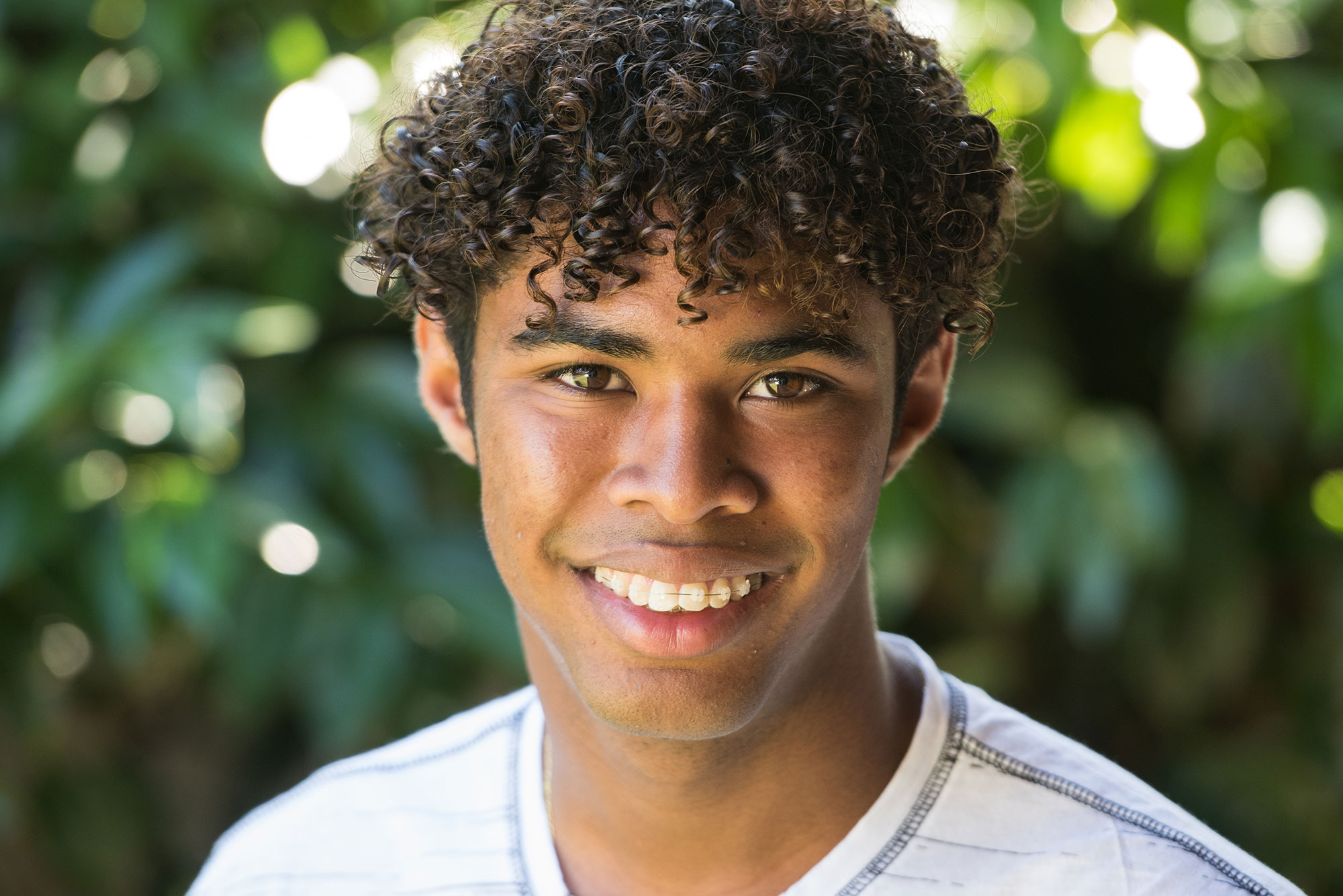 Image of clear braces.