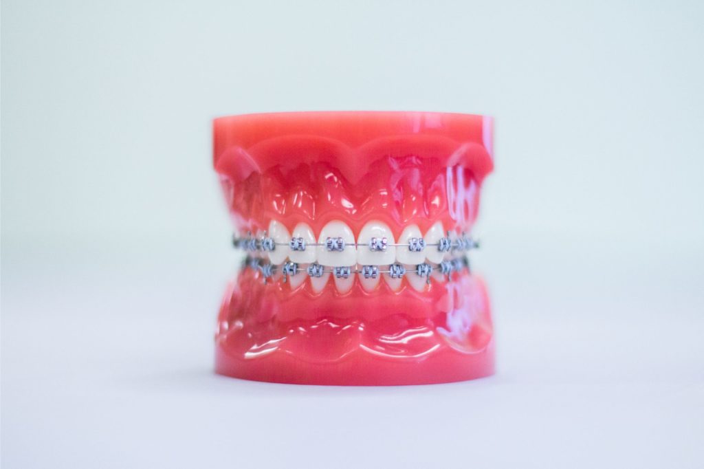 Patient with braces at Miami Orthodontic Specialists in Miami